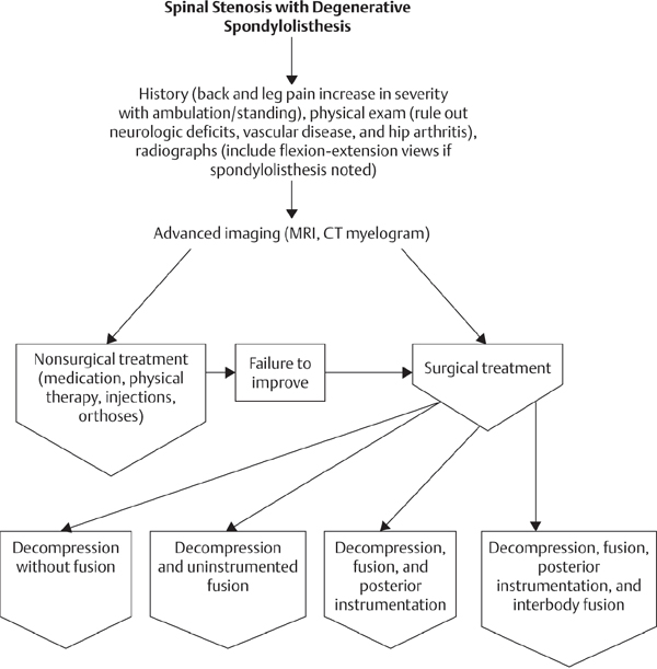 Lumbar Spinal Stenosis | Musculoskeletal Key