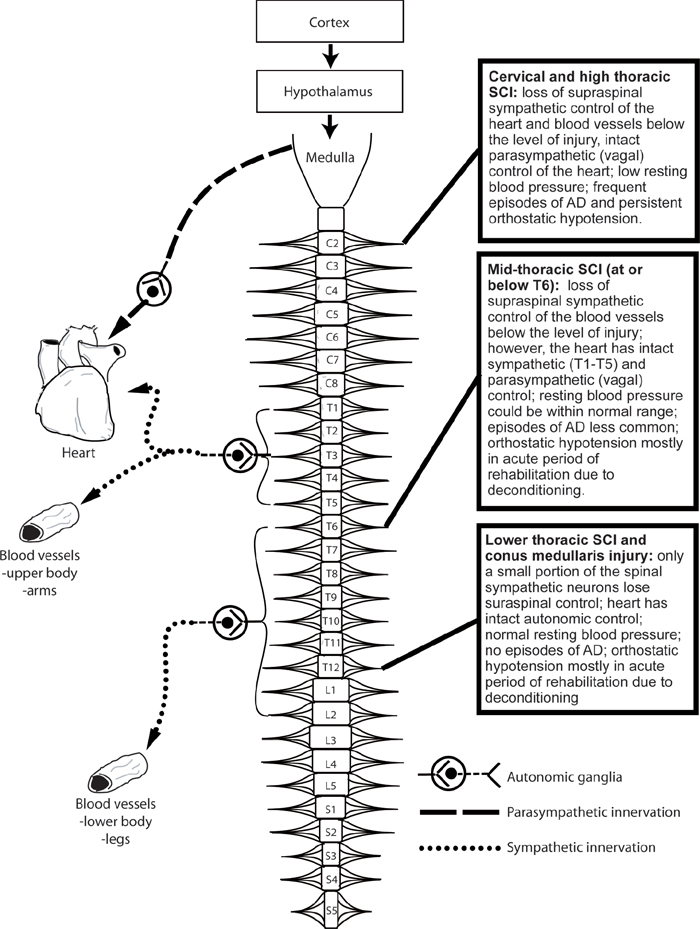 Autonomic Dysreflexia And Cardiovascular Complications Of Spinal Cord Injury Musculoskeletal Key