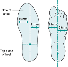 Footwear assessment | Musculoskeletal Key