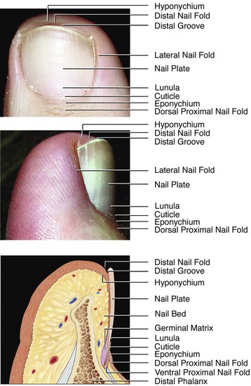 Ultrasound of Nail Conditions | SpringerLink