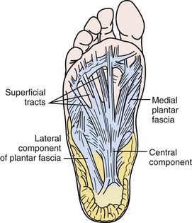 Plantar Heel Pain | Musculoskeletal Key