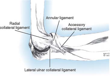 Lateral Collateral Ligament Insufficiency | Musculoskeletal Key