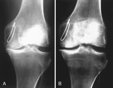 Radiographic Positioning Examples of the Leg and Knee - CE4RT