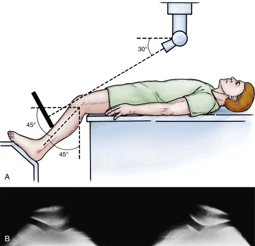 Knee Imaging Techniques And Normal Anatomy | Musculoskeletal Key