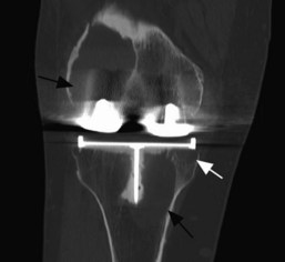 Knee Imaging Techniques and Normal Anatomy | Musculoskeletal Key