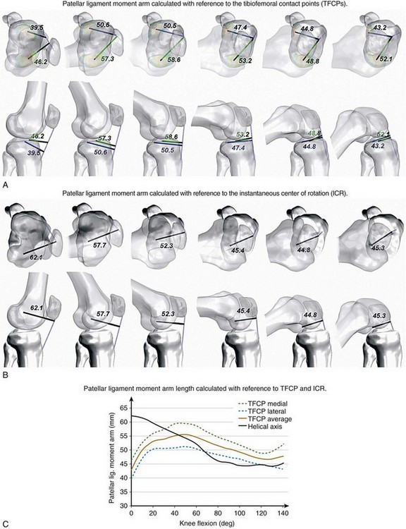 Biomechanics And Vibroarthrography Of The Patellofemoral Joint ...