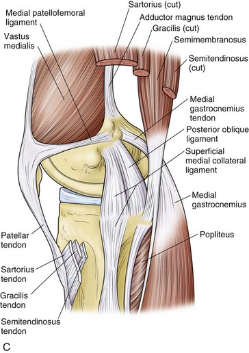 Classification of Knee Ligament Injuries | Musculoskeletal Key