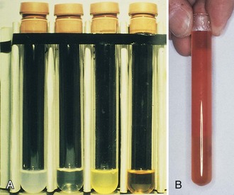 infected synovial fluid color