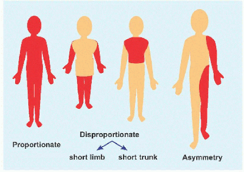 hypochondroplasia symptoms