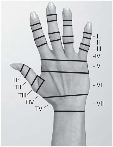 The Wrist and Hand | Musculoskeletal Key