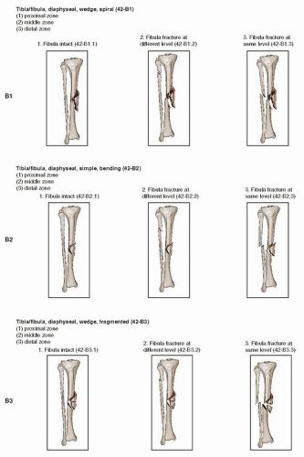 Intraoperative fluoroscopy with AP (A) and lateral (B) views of knee... |  Download Scientific Diagram