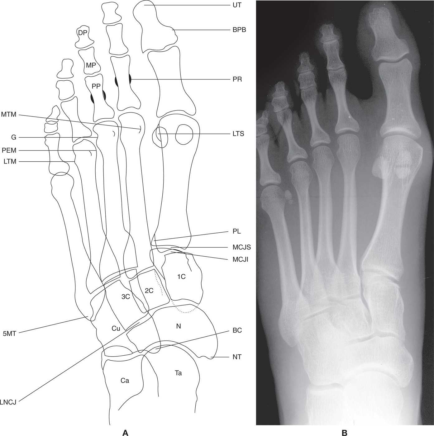 foot bone anatomy xray