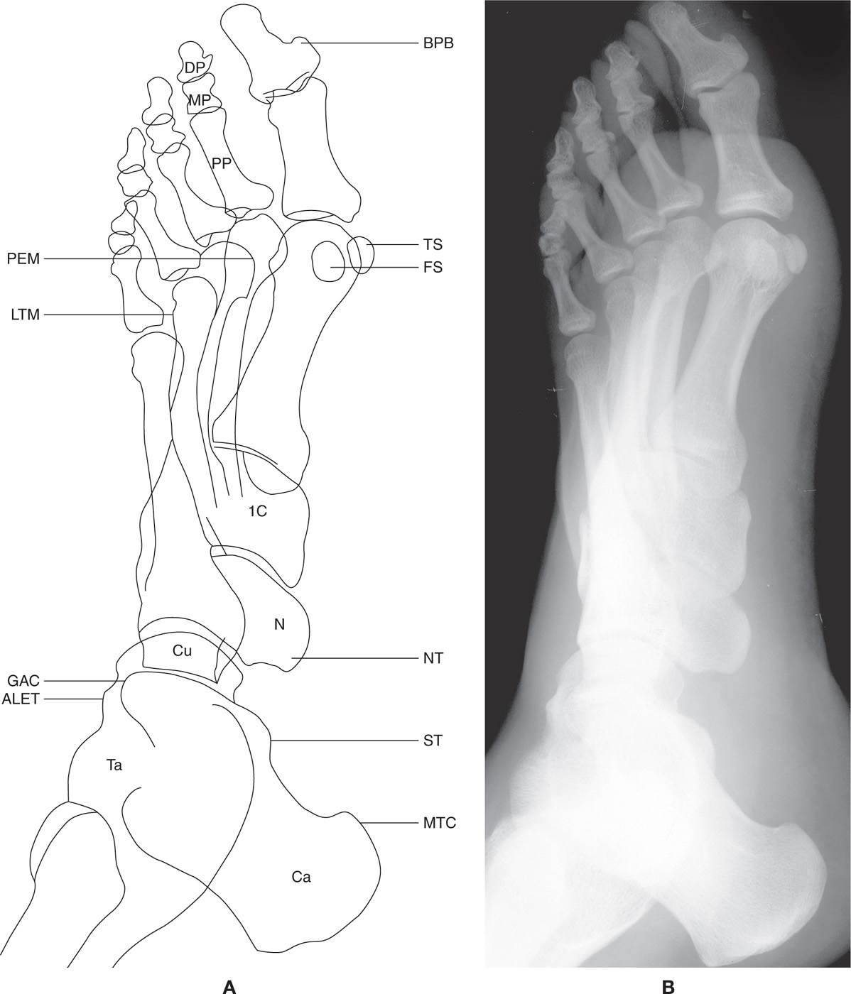 Normal Foot Xray