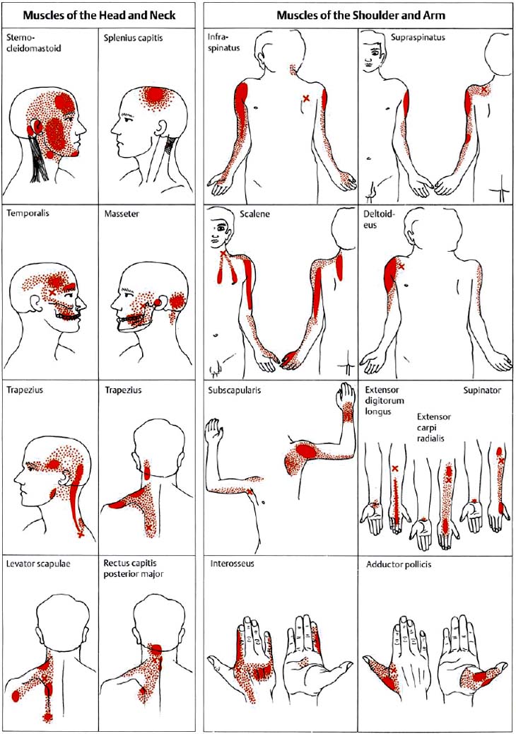 Massage Back Muscle Chart Pin By Andy Post On Exercises With Images Gym Workout A