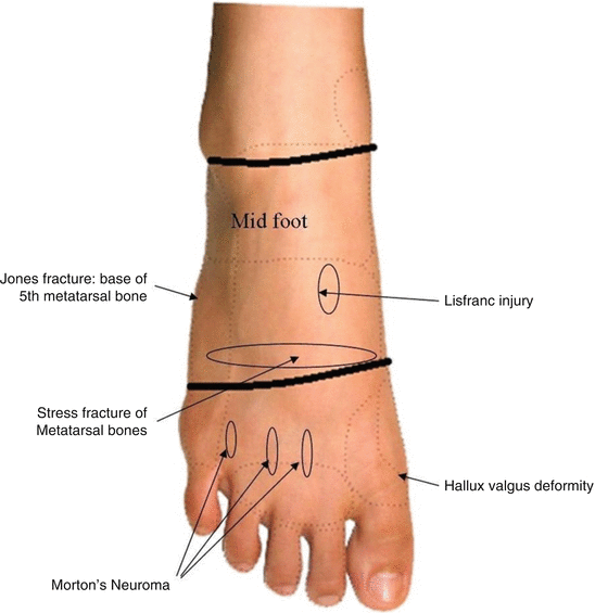 The Foot | Musculoskeletal Key