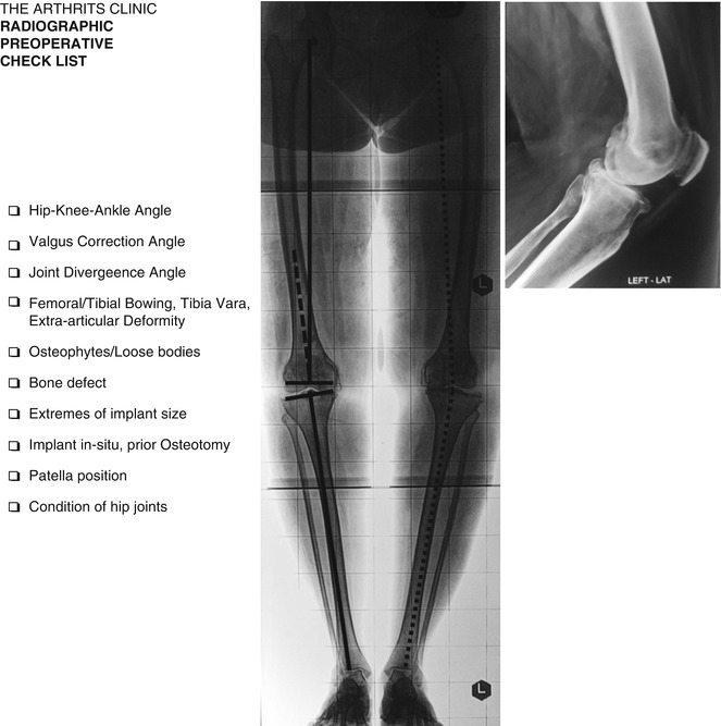 Musculoskeletal Key