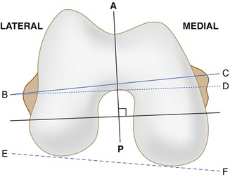 A215070_1_En_7_Fig1_HTML.jpg