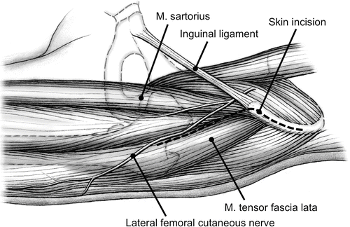 A308160_1_En_116_Fig3_HTML.gif