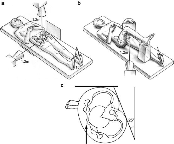 A308160_1_En_3_Fig4_HTML.jpg