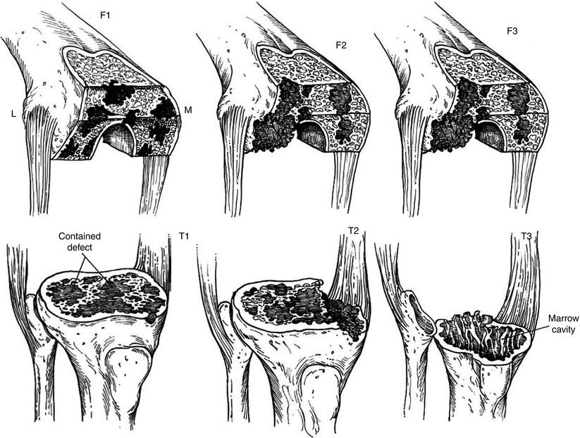 A314929_1_En_5_Fig2_HTML.jpg