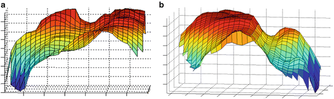 A319017_1_En_1_Fig4_HTML.gif