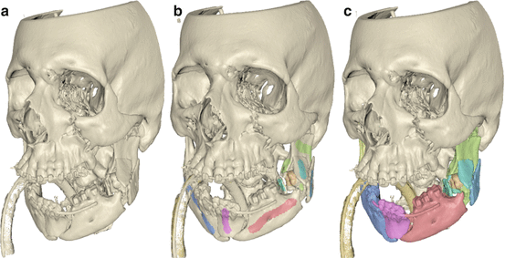 A321277_1_En_4_Fig3_HTML.gif