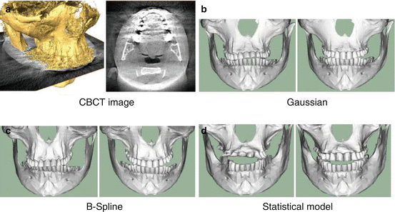 A321277_1_En_5_Fig2_HTML.gif