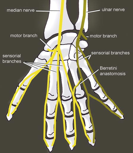 Entrapment Syndromes of the Median Nerve | Musculoskeletal Key