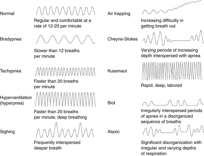xlist of brainwave patterns
