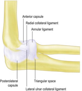 Pathogenesis of Chronic Elbow Instability | Musculoskeletal Key