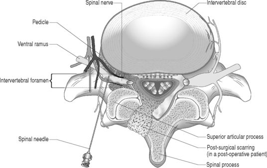 Postoperative Rehabilitation | Musculoskeletal Key