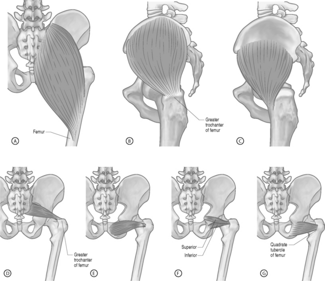 What Is Piriformis Syndrome? - MASS4D® Foot Orthotics