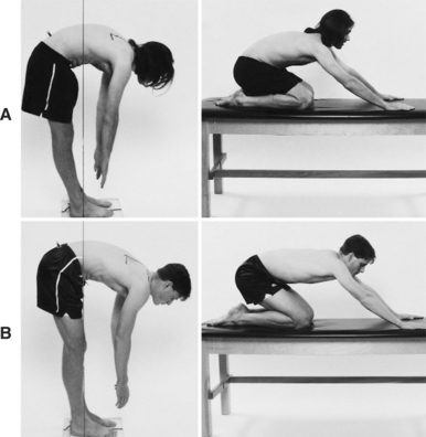 Movement Impairment Syndromes of the Lumbar Spine