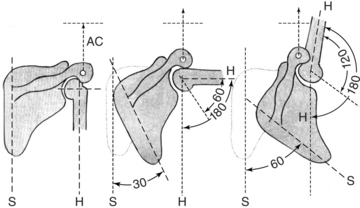 Movement Impairment Syndromes of the Shoulder Girdle