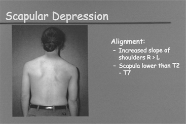 shoulder depression