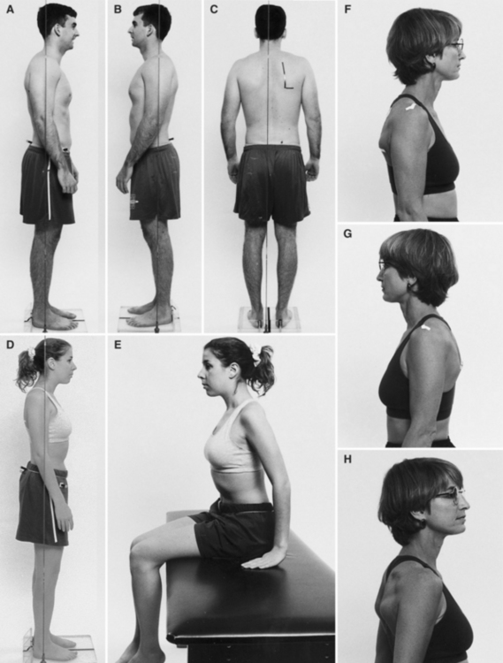 Movement Impairment Syndromes of the Shoulder Girdle | Musculoskeletal Key