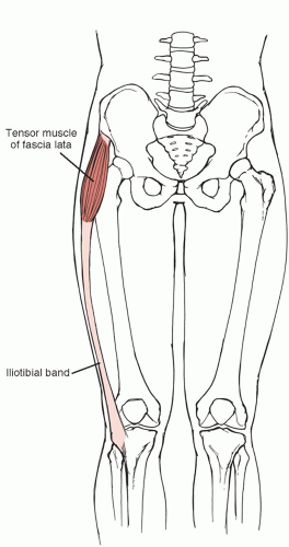 Athlete with Knee Pain | Musculoskeletal Key