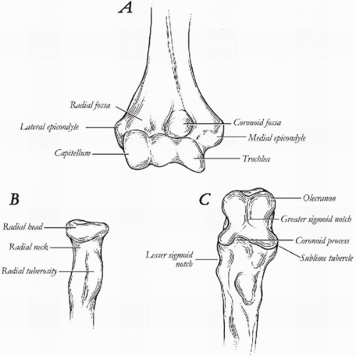 Total Elbow Arthroplasty Design | Musculoskeletal Key