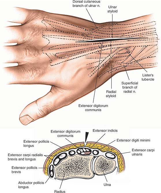 Hand And Wrist Anatomical Chart | lupon.gov.ph