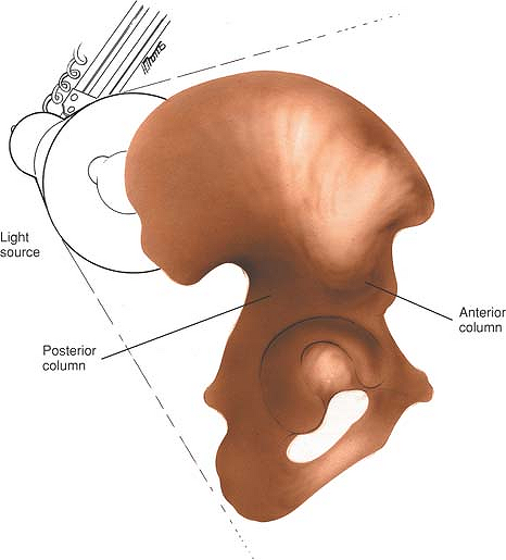 acetabulum of pelvis