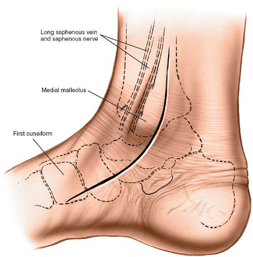 medial malleolus