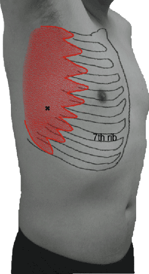 Pictorial Guide to Muscles and Surface Anatomy | Musculoskeletal Key