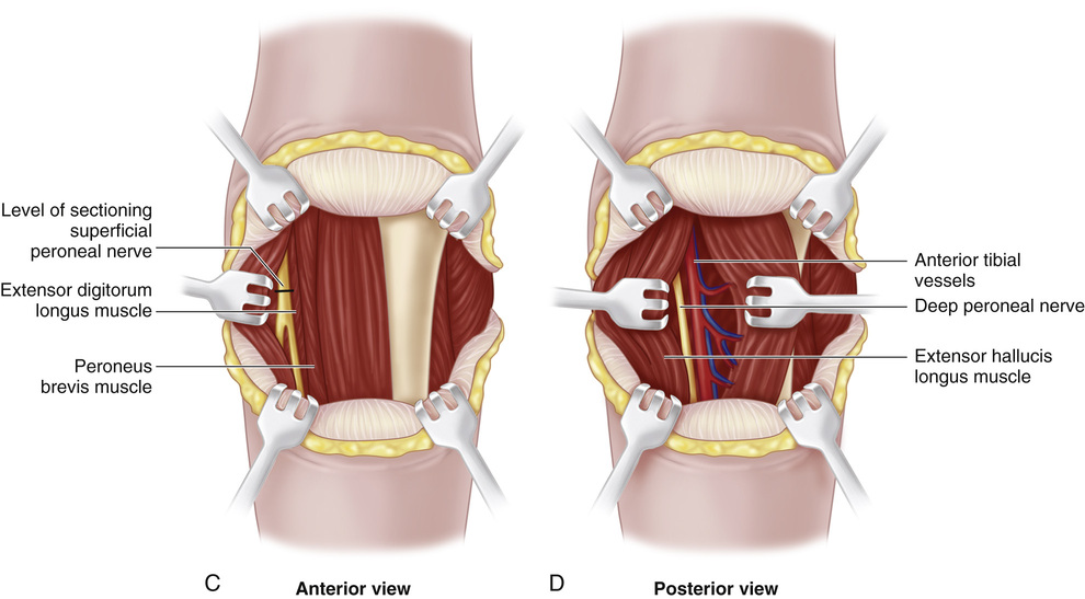 Beneath be adenine show on ampere estimator IODIN establish stylish mys vicinity CVS medical