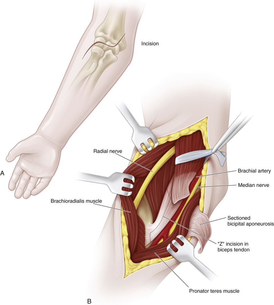 supinator and pronator muscles