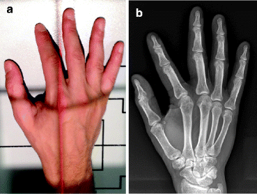 Betts View Xray Cheap Sale Emergencydentistry Betts View Xray Cheap Sale Emergencydentistry