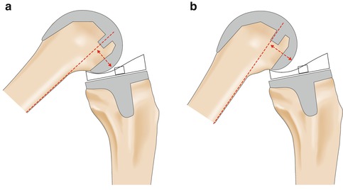 A314755_1_En_29_Fig2_HTML.jpg