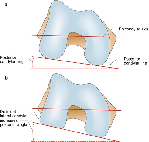 A314755_1_En_5_Fig3_HTML.jpg