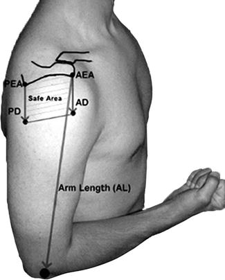 Axillary Nerve | Musculoskeletal Key