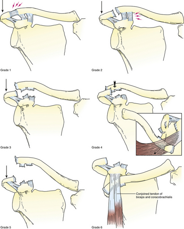 Common Issues in Orthopedics | Musculoskeletal Key