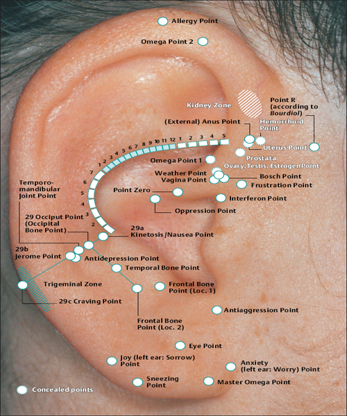 Basic Principles of Auricular Acupuncture Musculoskeletal Key